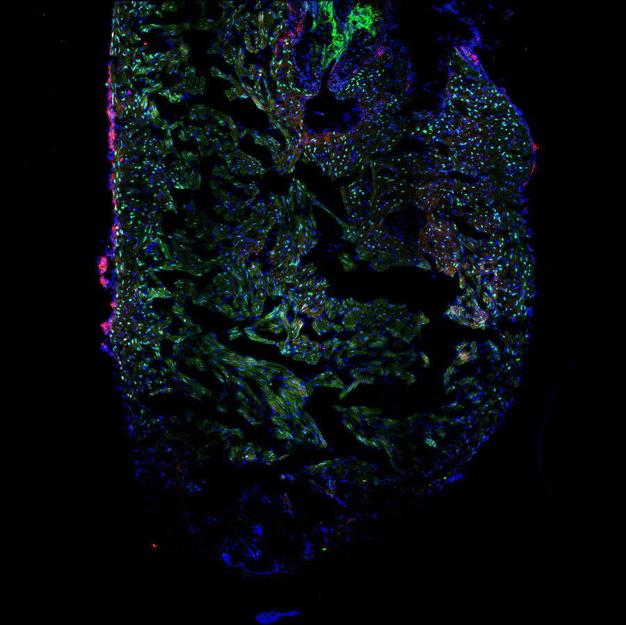Single slice taken from a zebrafish heart showing the ventricle with an injury in the lower area. 