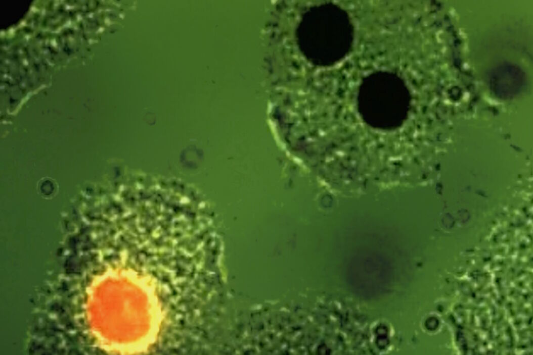 Fluorescence microscopy image of liver tissue where DNA in the nuclei are stained with Feulgen-pararosanilin and visualized with transmitted green light. Fluorescence_microscopy_image_of_liver_tissue.jpg