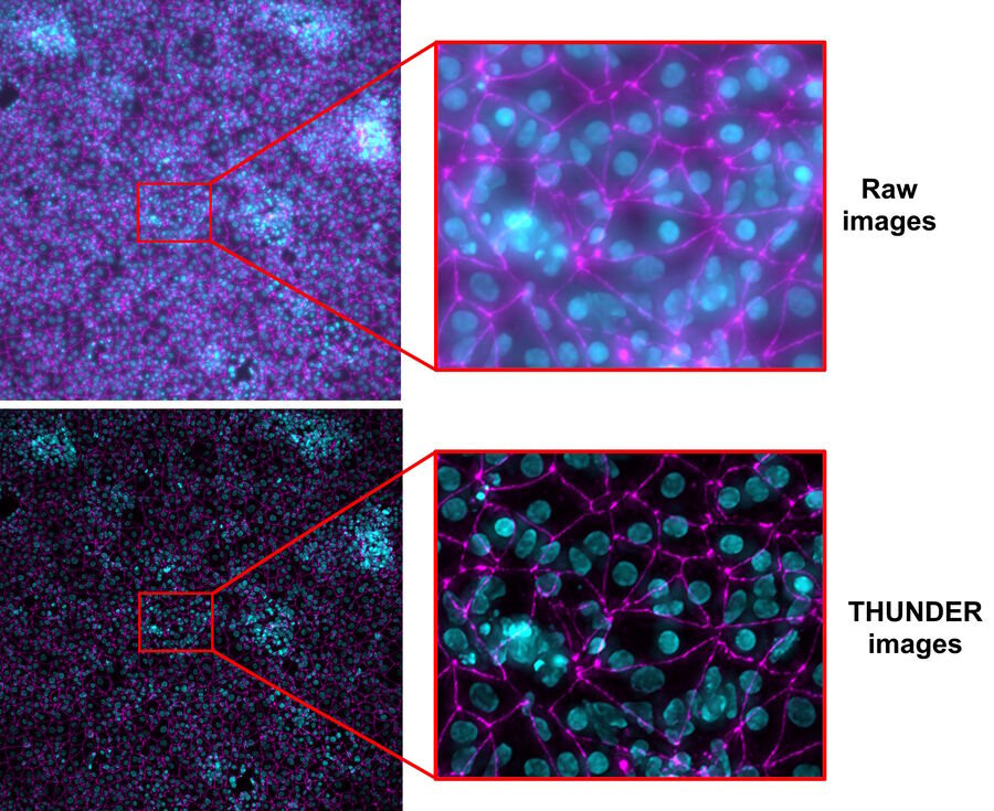 图5：细胞培养插板中活iPSC衍生的内皮样细胞的原始宽场显微镜图像和THUNDER图像的对比。对于THUNDER成像，与常规宽场显微镜不同，插板无需从多孔板中取出。THUNDER图像经过计算清除法处理。