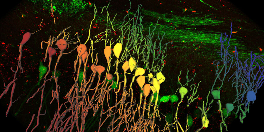 YFP-Mausgehirnschnitte, gefärbt mit GFAP-A647. Mit dem THUNDER Imager Tissue aufgenommen und mittels dem 3D Neuron Analysis – FL in Aivia analysiert.  Bildreferenz von Dr. Hong Xu, University of Pennsylvania, Philadelphia.