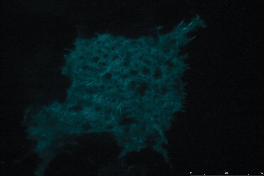 Widefield image of Galectin3 expressing YFP