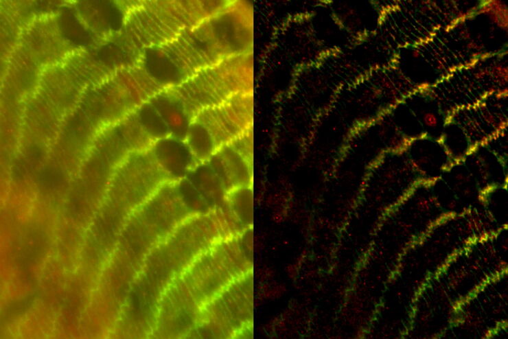 [Translate to chinese:] Raw widefield and THUNDER image of transversal mouse adult fiber lens section. Courtesy N. Houssin, Plagemen lab, Ohio State University, Columbus, USA.