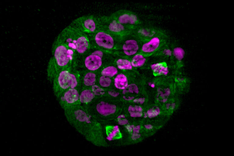 使用 DLS 进行类器官或类球体光片实验可以达到大于 100 微米的成像深度。 活乳腺上皮细胞类球体：绿色-细胞核，（MCF10A H2B-GFP）；红色-微管蛋白细胞骨架（SiR- 微管蛋白）；使用 LIGTHNING 处理的 DLS 数据。 由德国海德堡 BioQuant/德国癌症研究中心（DKFZ）的 B. Eismann 和 C. Conrad 提供。
