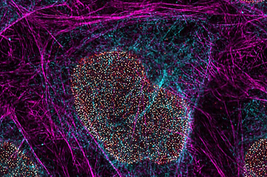 Multicolor TauSTED Xtend 775 for Cell Biology applications that require nanoscopy resolution for multiple cellular components. Cells showing vimentin fibrils (AF 594), actin network (ATTO 647N), and nuclear pore basket (CF 680R). Sample courtesy of Brigitte Bergner, Mariano Gonzales Pisfil, Steffen Dietzel, Core Facility Bioimaging, Biomedical Center, Ludwig-Maximilians-University, Munich, Germany.