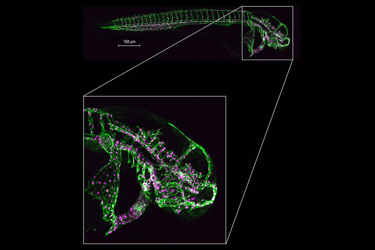 大型全样本的高分辨率成像： 区块扫描选项能够以高分辨率对大型样本进行完整成像，如此处所示的整个斑马鱼胚胎。 由法国伊利基希-格拉芬斯塔登 IGBMC 成像中心 Elvire Guiot 和英国伦敦帝国学院 Julien Vermot 提供。
