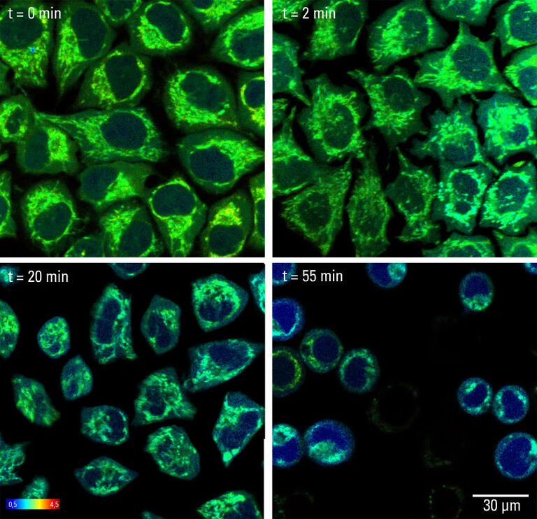 非生理条件下哺乳动物细胞的自发荧光 （酸碱度为 8.5）。 信号与内源性 NAD/NADH 的变化相关。 氧化应激的发展表现为荧光寿命随时间缩短。 原始图像大小： 512 x 512 像素。 颜色条的尺度（寿命）：ns。