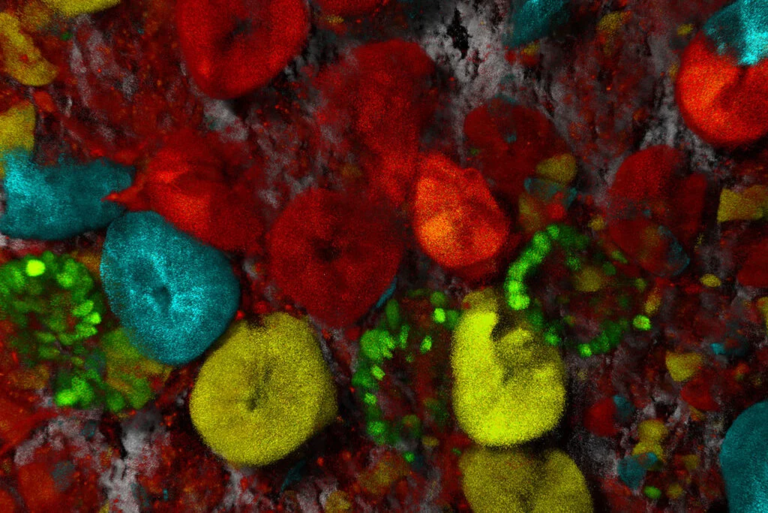 五彩斑斓的小鼠小肠：胶原蛋白 1 显示为灰色（无标记 SHG），谱系追踪干细胞显示为青色、绿色、黄色和红色。干细胞在生物体内癌症的传播中发挥着重要作用。样品由荷兰癌症研究所的 Jacco van Rheenen 提供。