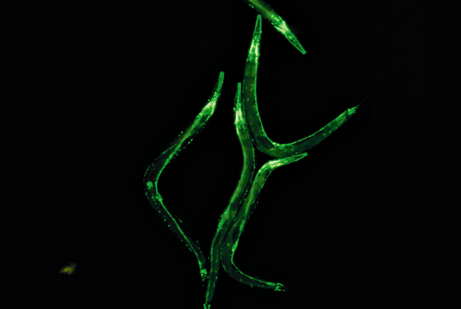 C.elegans, GFP expression in the nervous system.
