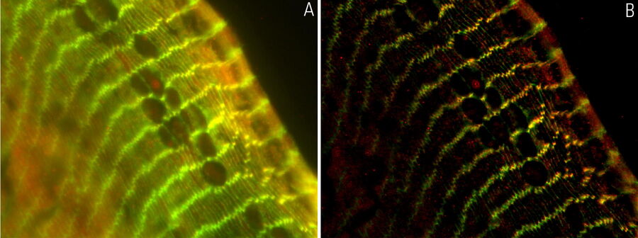 A) raw widefield image and B) image after LVCC of a transversal mouse adult fiber lens section. The images show the cell organization where green indicates BDB610153 membrane proteins, red Afadin actin filament-binding proteins, and blue nuclei.