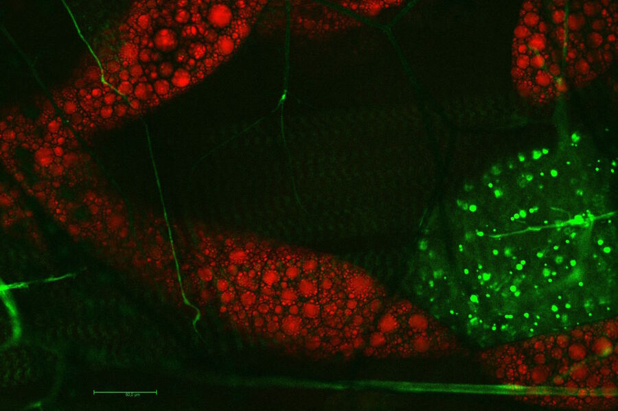In vivo imaging of a larvae of a fruit fly (Drosophila melanogaster). Fat cells are shown in red at a wave number of 2,850 cm–1 (at 816 nm).