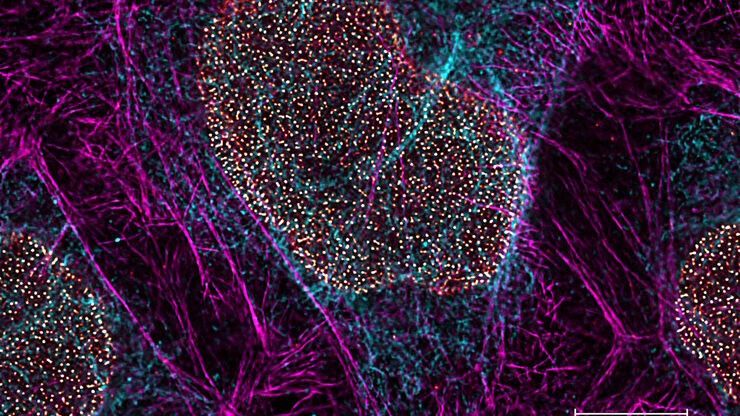 Multicolor TauSTED Xtend 775 for Cell Biology applications that require nanoscopy resolution for multiple cellular components. Cells showing vimentin fibrils (AF 594), actin network (ATTO 647N), and nuclear pore basket (CF 680R). Sample courtesy of Brigitte Bergner, Mariano Gonzales Pisfil, Steffen Dietzel, Core Facility Bioimaging, Biomedical Center, Ludwig-Maximilians-University, Munich, Germany.