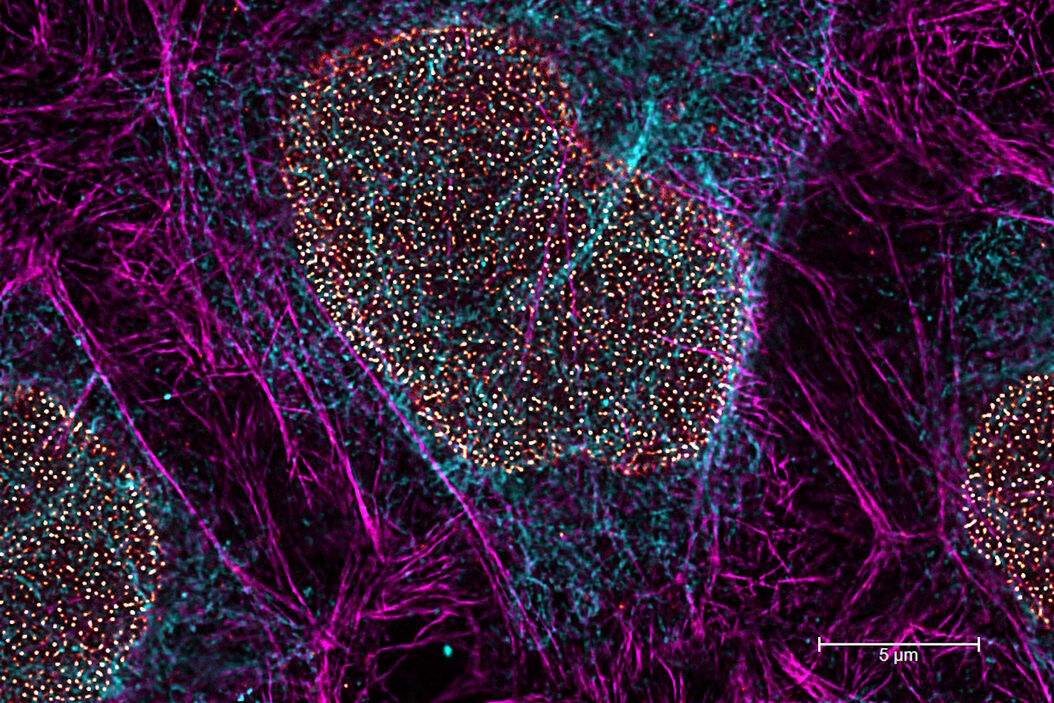 Multicolor TauSTED Xtend 775 for Cell Biology applications that require nanoscopy resolution for multiple cellular components. Cells showing vimentin fibrils (AF 594), actin network (ATTO 647N), and nuclear pore basket (CF 680R). Sample courtesy of Brigitte Bergner, Mariano Gonzales Pisfil, Steffen Dietzel, Core Facility Bioimaging, Biomedical Center, Ludwig-Maximilians-University, Munich, Germany. Triple_color_fixed_sample_TauSTED_Xtend_2_3.jpg