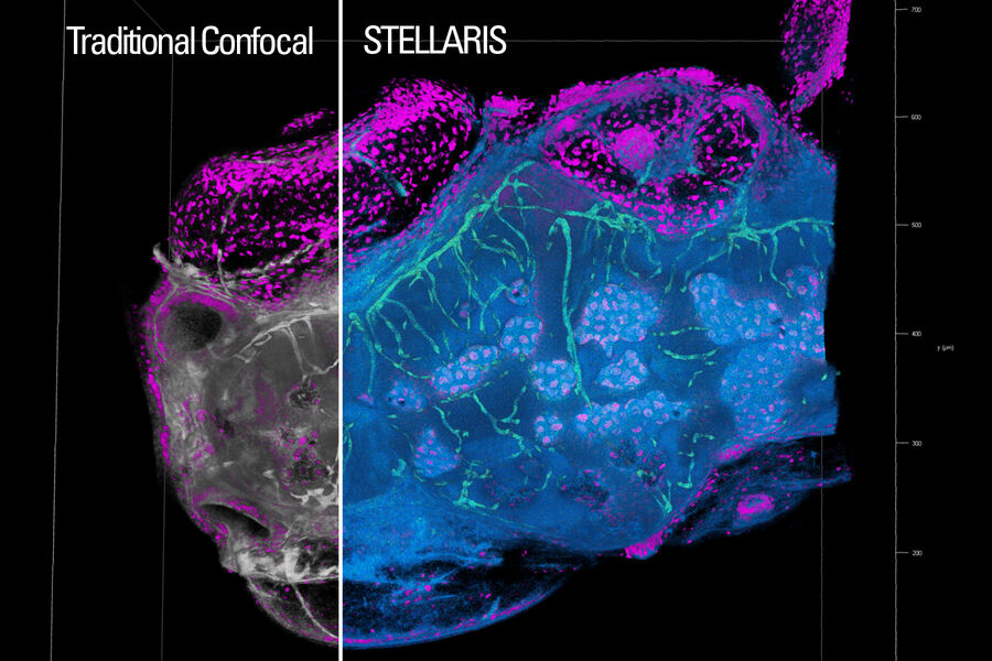 斑马鱼胚胎。 绿色： 血管，EGFP/紫色： 细胞核，Hoechst。 使用TauContrast识别血管标记；来源于寿命的信息将血管信号与内源性信号区分开来。 由法国斯特拉斯堡的IGBMC的Laia Ortiz Lopez和Julien Vermot友情提供。
