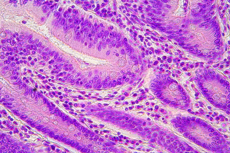 [Translate to chinese:] This image shows nuclei in the duodenum close up