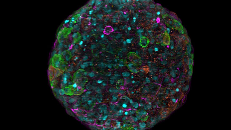 [Translate to chinese:] Spheroid stained with Cyan: Dapi nuclear countertain; Green AF488 Involucrin; Orange AF55 Phalloidin Actin; Magenta AF647 CK14.