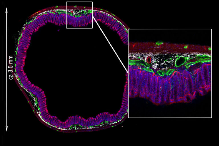 RapidClearで透明化処理された直径3.5 mmの腸断面をNavigatorで画像化。 B/W: SHG –コラーゲン、青色： Sytox Orange – 核、緑色： Alexa 633 －神経細胞、赤色： Alexa 488 –血管。 提供： SunJin Labs。