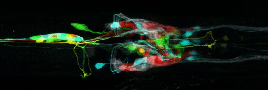Fig. 10: Leica confocal image of the brain and nervous system of C. elegans (viewed from ventral side of worm). The neuron cells are expressing the fluorescent proteins CFP, GFP, YFP, and DsRed, and additionally labelled with the white lipophilic tracer dye DiD. Image courtesy of H. Hutter, Dept. of Biological Sciences, Simon Fraser University, Burnaby, BC, Canada [26].