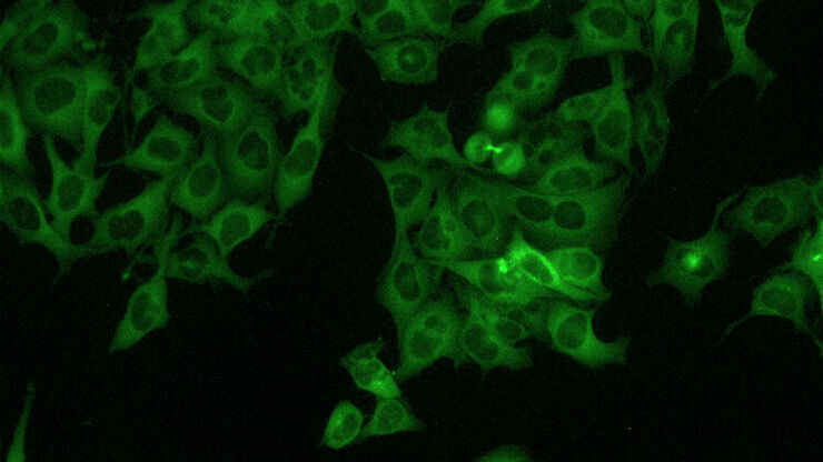 [Translate to portuquese:] HeLa Cells 20x Fluorescence
