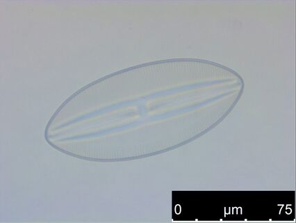 Fixed maritime diatoms on a glass slide.