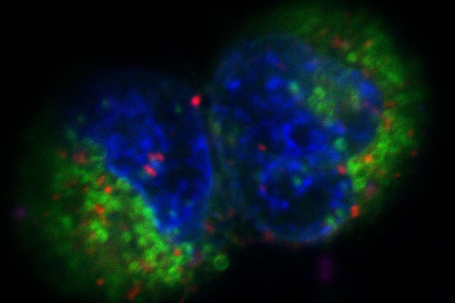 Projection of a confocal z-stack. Sum159 cells, human breast cancer cells kindly provided by Ievgeniia Zagoriy, Mahamid Group, EMBL Heidelberg, Germany. Blue–Hoechst - indicates nuclei, Green–MitoTracker Green–mitochondria, and red–Bodipy - lipid droplets