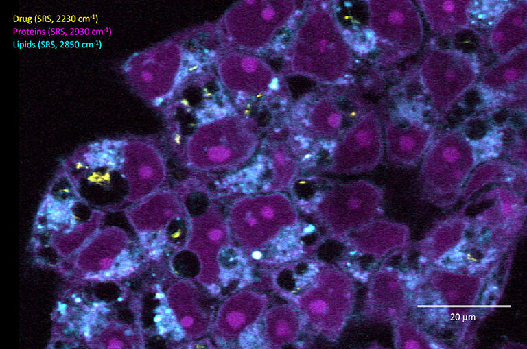多色SRS成像展示了拉曼标记药理学化合物（黄色，SRS成像，波数为2230 cm⁻¹）在无标记细胞样本内的内源性脂质和蛋白质环境中的亚细胞分布。 样本由Dewpoint Therapeutics GmbH的Matthäus Mittasch博士提供。