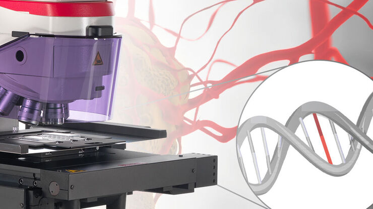 Automated Laser Microdissection for Proteome Analysis
