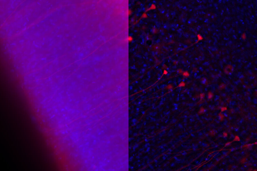 DISCO, Ferret brain, rabies infected - THUNDER Imager 3D Cell Culture