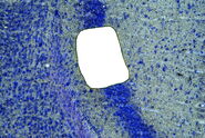 [Translate to chinese:] Image of murine-brain tissue showing a region removed with UV laser microdissection.