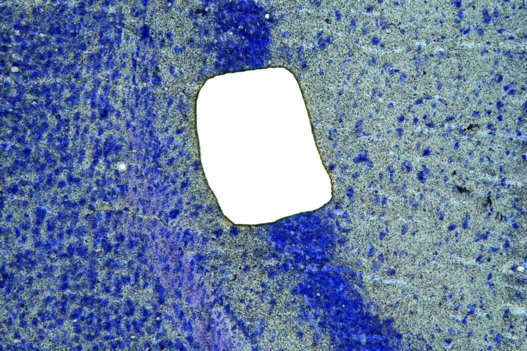 [Translate to chinese:] Image of murine-brain tissue showing a region removed with UV laser microdissection. Murine-brain_tissue_showing_a_region_removed_with_UV_LMD.jpg