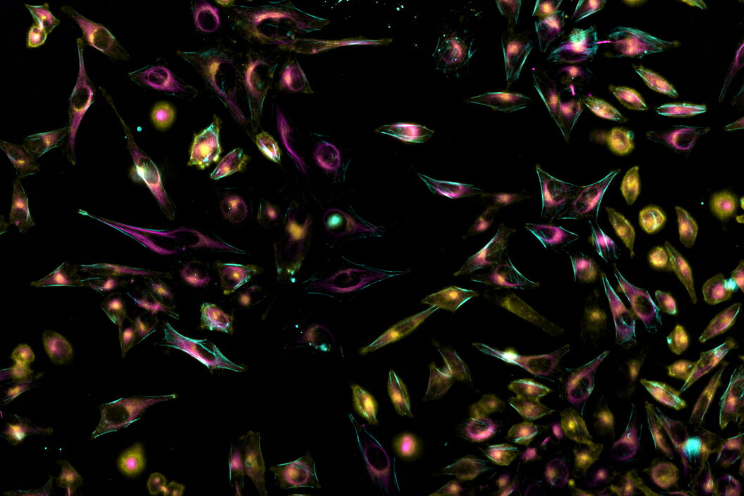 Living HeLa cells stained with WGA-488 (yellow), SPY-Actin (cyan), and SiR-Tubulin (magenta). Instant Computational Clearing (ICC) was applied. Living_HeLa_cells_Instant_Computational_Clearing.jpg