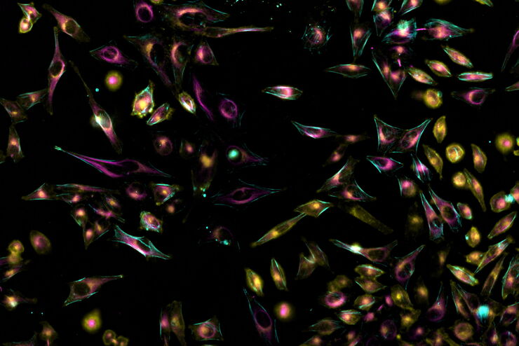 [Translate to chinese:] Living HeLa cells stained with WGA-488 (yellow), SPY-Actin (cyan), and SiR-Tubulin (magenta). Instant Computational Clearing (ICC) was applied.