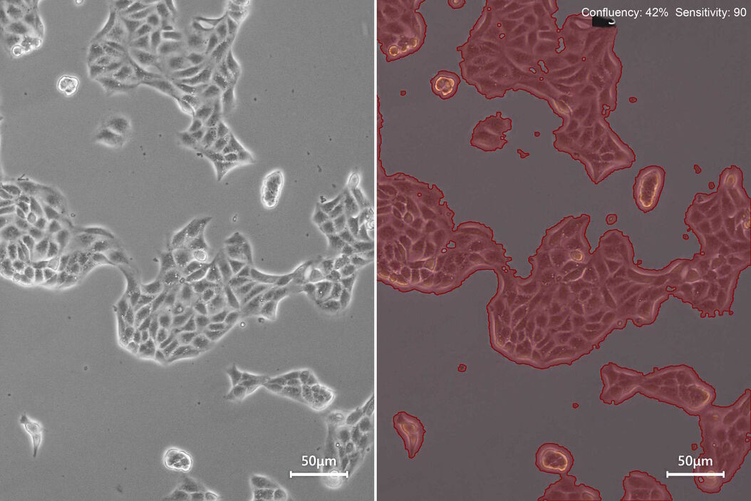 [Translate to chinese:] Phase-contrast image of a MDCK-cell culture and its respective confluency measured by the Mateo TL microscope. Phase-contrast_image_of_a_MDCK-cell_culture_respective_confluency_Mateo_TL.jpg