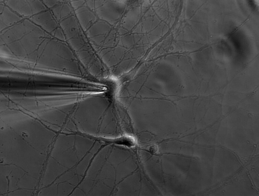 A phase contrast image of a patch pipette attached to the membrane of a cultured murine hippocampal neuron. The image is courtesy of Dr. Ainhara Aguado, Ruhr University Bochum, Germany.