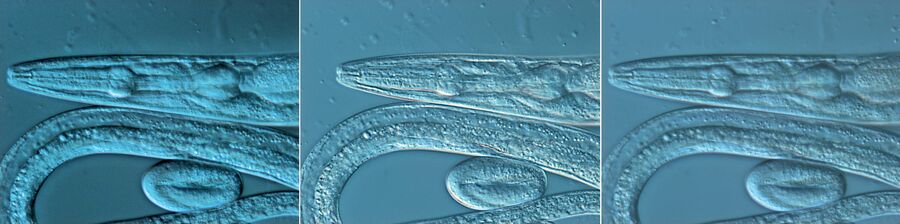 DIC images of C. elegans (roundworm) recorded with Wollaston prisms having different splitting angles.
