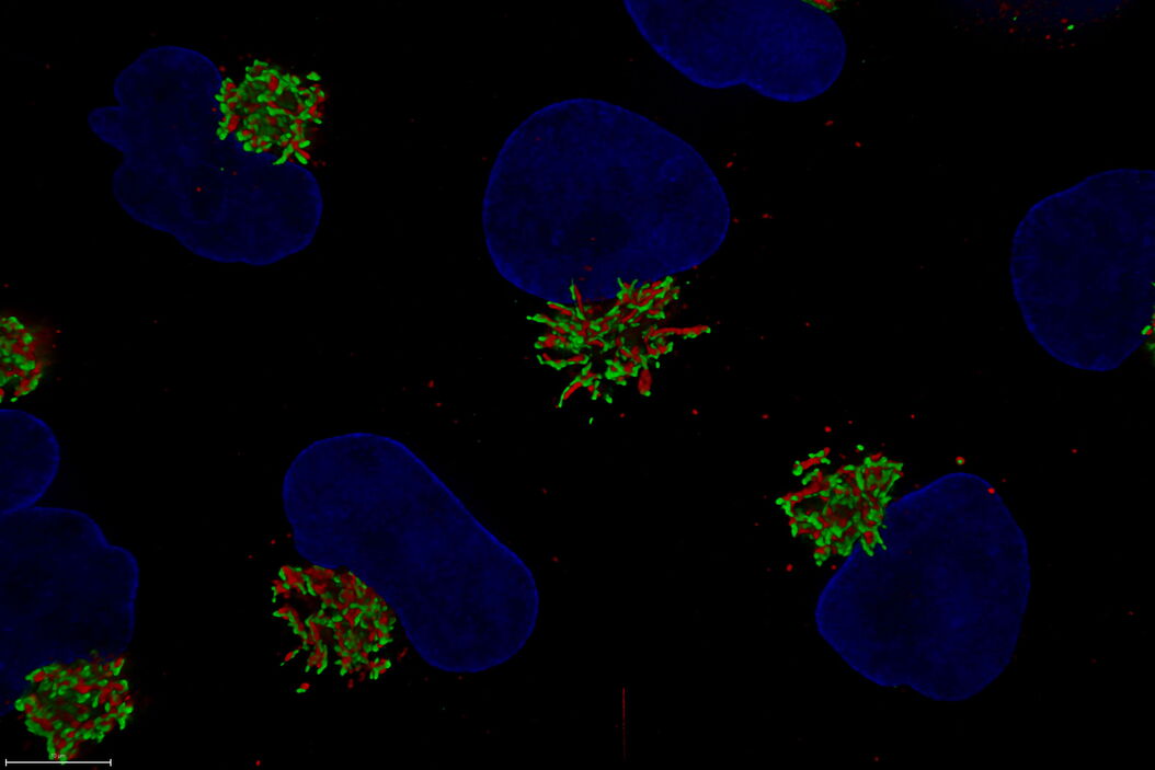 [Translate to chinese:] Untreated Hela Kyoto cells stained to show the nucleus (Hoechst, blue), the cis-golgi matrix protein GM130 (AF488, green), and the trans-golgi network membrane protein TGN46 (AF647, red).  Untreated_Hela_Kyoto_cells_acquired_on_Mica_using_THUNDER_grade_processing.jpg