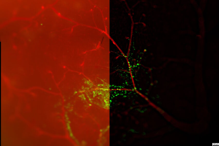 Mouse brain cortex displaying 500 nm green fluorescent beads in perivascular space. Blood vessels are stained with WGA lectin conjugated with Alexa 594 fluorophore. Sample courtesy of PhD Mika Kaakinen and M.Sc. Abhishek Singh, Biocenter Oulu, University of Oulu, Finland. Sample imaged by Janne Ylärinne, PhD, Immuno Diagnostic Oy. 