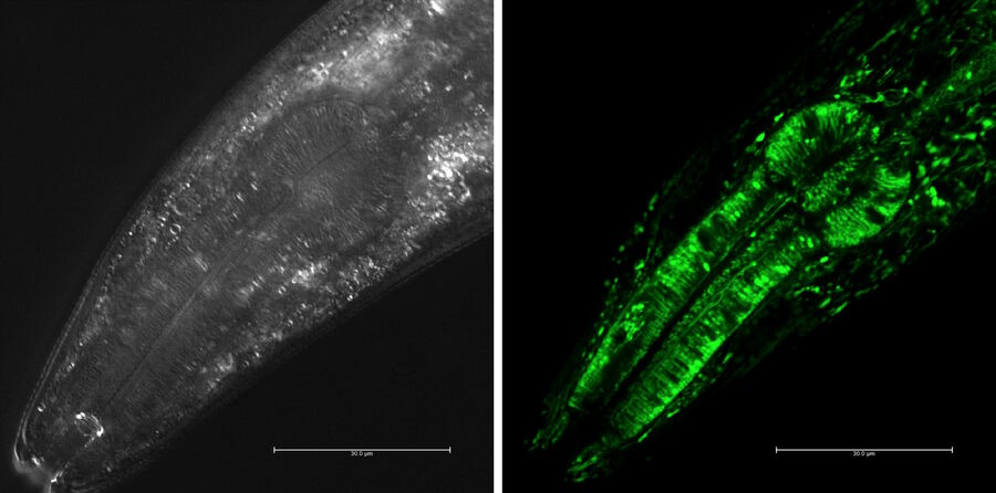 Fig. 9: Brightfield (left) and confocal (right) image of the pharynx of C. elegans expressing GFP. Both images were taken with a Leica confocal microscope system.