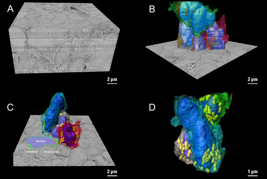 3D image reconstructions of mouse lymph nodes acquired with array topography