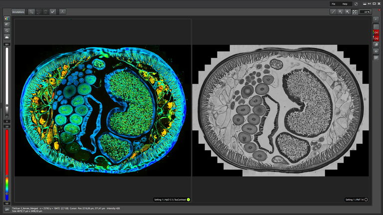 Identification of distinct structures in a transverse section of roundworm. The combination of the fluorescence lifetime-based information and the fluorescence intensity with a stage application, gives an extra layer of contrast to tell different structures apart. LAS X Navigator enables this task to be performed seamlessly over the entire specimen.