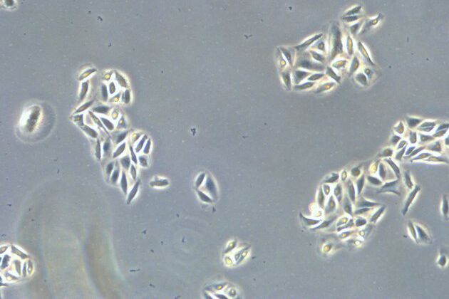 Microscope image of cultured cells at the bottom of a dish. CellCheck-17-cells-grow-divide.jpg