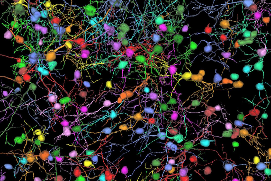 [Translate to chinese:] THY1-EGFP labeled neurons in mouse brain processed using the PEGASOS 2 tissue clearing method, imaged on a Leica confocal microscope. Neurons were traced using Aivia’s 3D Neuron Analysis – FL recipe. Image credit: Hu Zhao, Chinese Institute for Brain Research. Neurons_in_mouse_brain_with_Aivia_3D_Neuron_Analysis.jpg