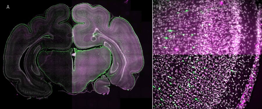 图 2：THUNDER成像仪记录的有计算清除（左）和无计算清除（右）的发育中雪貂大脑概览。(A）这里标记的是星形胶质细胞（绿色为星形胶质细胞）以及各种发育中的神经元（MCherry，品红色，使用子宫内电穿孔标记）。(B) 图像显示了带有电穿孔神经细胞（绿色）、特定神经元标记（品红色）和细胞核（白色）的切片。这里还可以清楚地看到计算清除（B，下）和不计算清除（B，上）的影响。