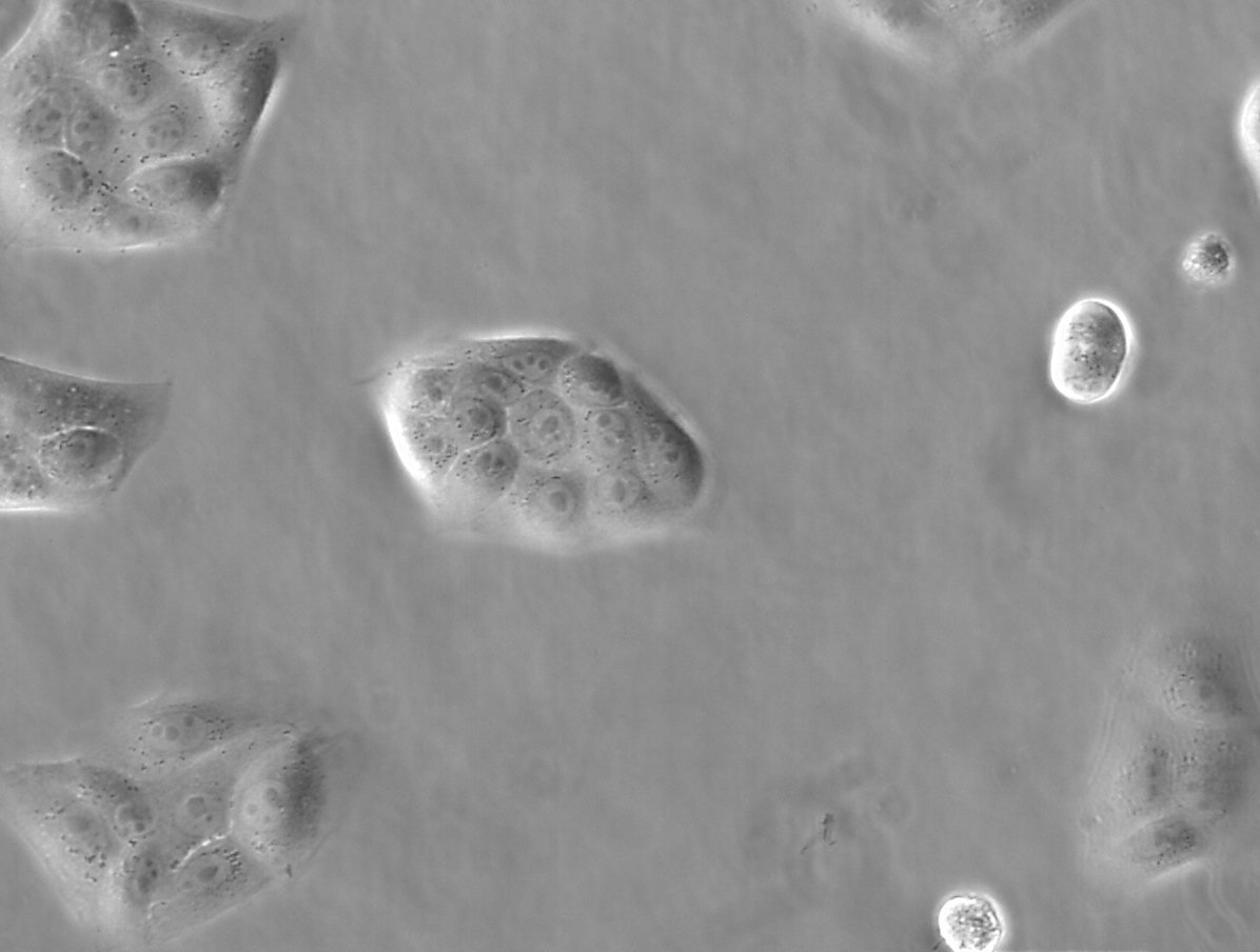 Phase Contrast MDCK cells, phase contrast microscope