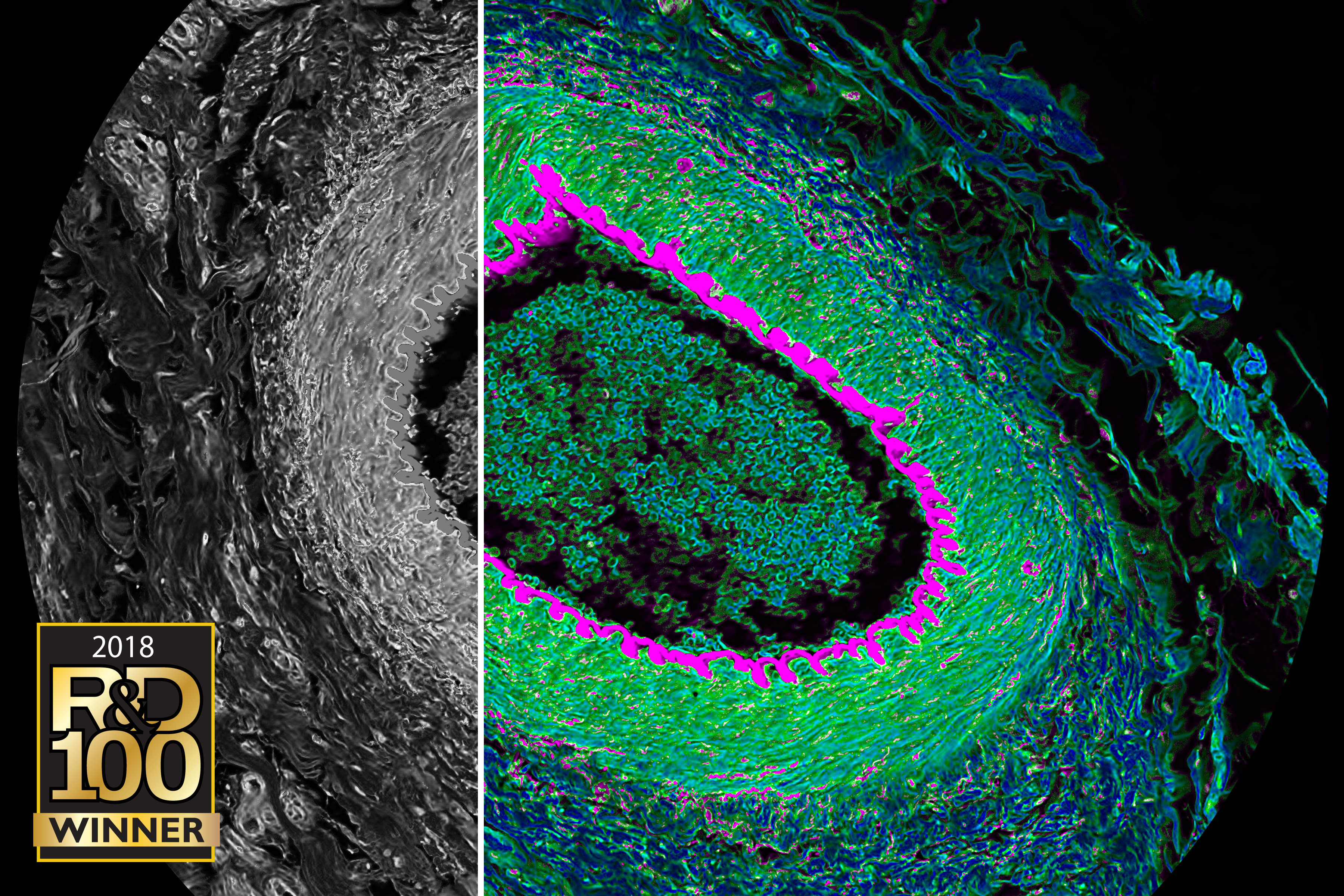 Coupe histologique d'un œil de chat. L'imagerie confocale spectrale (en gris) et FLIM (en couleur) simultanée révèle le contraste en temps de vie de fluorescence. Acquisition et visualisation par le SP8 FALCON et le logiciel LAS X.