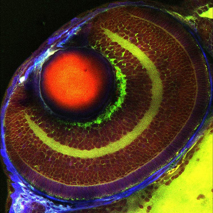 Imagem sobreposta mostrando o olho de um peixe-zebra intacto sem marcação. Verde: Imagem de dispersão estimulada de Raman (SRS) de componentes lipídicos (a 2850 cm⁻¹). Vermelho: Imagem SRS de componentes proteicos (a 2935 cm⁻¹). Azul: sinais de segundo harmônico, principalmente da esclera e córnea. Amostra fornecida por Elena Remacha Motta e Julien Vermot, Instituto de Genética e Biologia Molecular e Celular (IGBMC), Strasbourg, França.