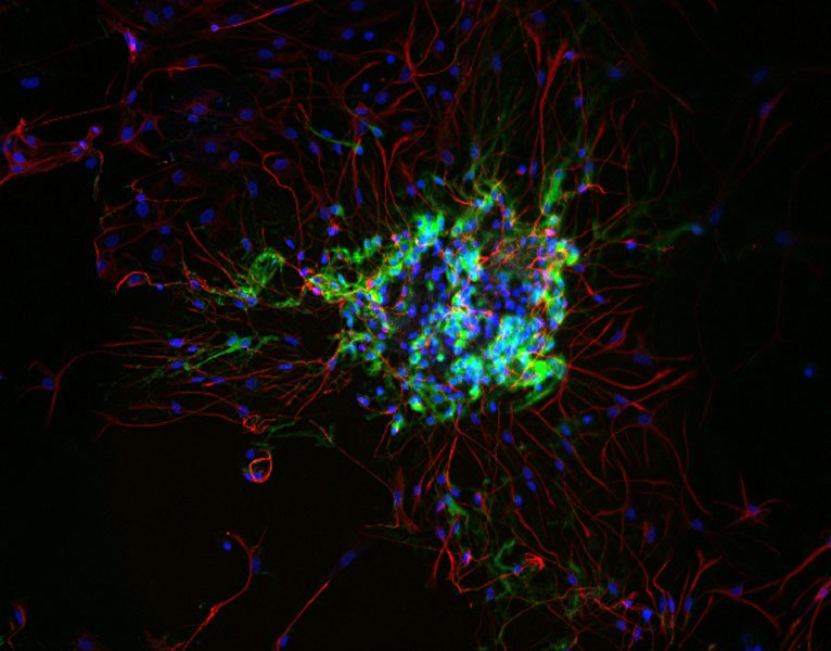 Синий: DAP I, ядра;  Зеленый: анти-Nestin-Cy2, астроциты;  Красный: бета-III-тубулин-Cy5