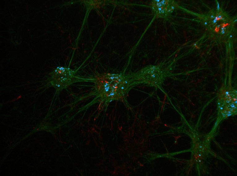 Culture de neurones marqués au DAPI, beta III Tubulin–Cy2,  Nestin-Cy3 (LMS Bioanalytik GmbH,  Magdeburg, Germany). Les noyaux cellulaires sont colorés en bleu, les neurones exprimant la beta III Tubulin apparaissent en vert et en rouge les cellules souches exprimant la Nestin. Image acquise avec le stéréomicroscope Leica M205 FCA , équipé d'une platine motorisés LMT260, d'une caméra monochrome Leica DFC3000 G et d'un Fluocombi et au grossissement 400x.