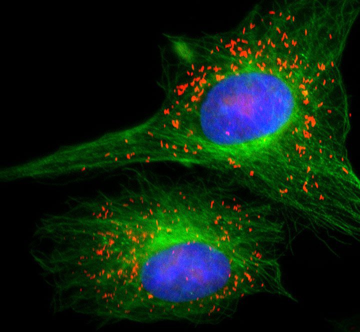 Cellule Vero marcate con DAPI, anti-tubulina e anti-Pmp-70 (peroxisomes)