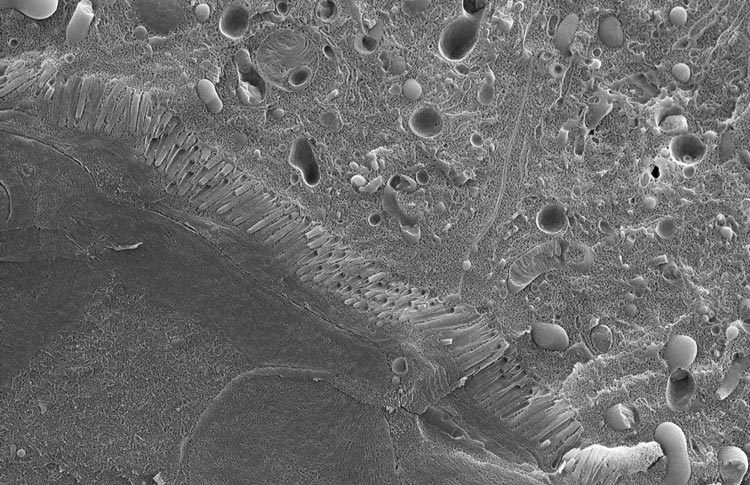 Larva de Drosophila. Preparación de la muestra y obtención de la imagen por Andres Käch, muestra por cortesía del grupo del Prof. Damian Brunner, Instituto de Biología Molecular, Universidad de Zúrich, Suiza. Partes visibles: músculo, vellosidades y orgánulos celulares (p. e. mitocondrias)
