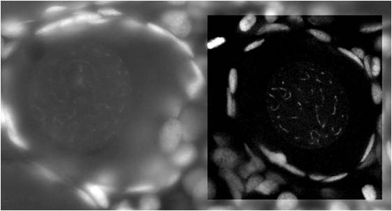 Comparison of confocal confocal and non-confocal imaging. Feulgen-stained mouse-trophoblast image with an inserted region of interest. In the region of interest, the image is recorded with a true confocal scanner system (point-illumination and point-detec